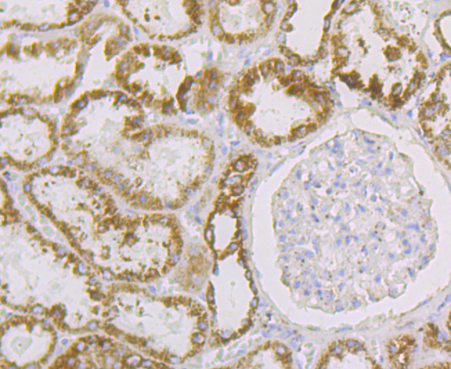 Aconitase 2 Rabbit mAb