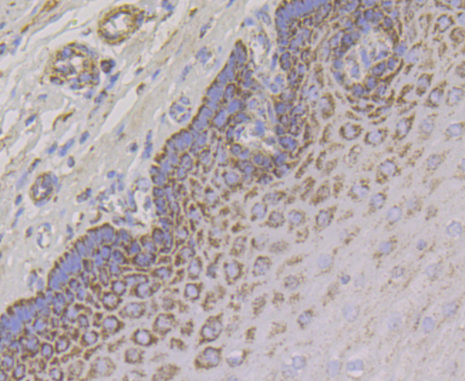 Aconitase 2 Rabbit mAb