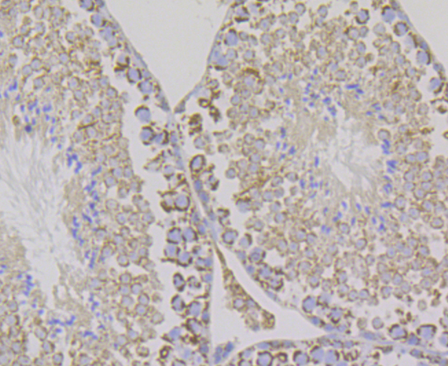 Aconitase 2 Rabbit mAb