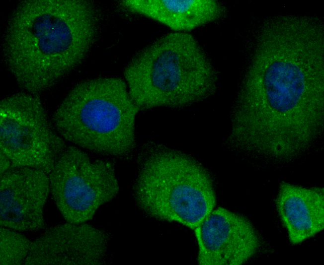 IMPDH2 Rabbit mAb