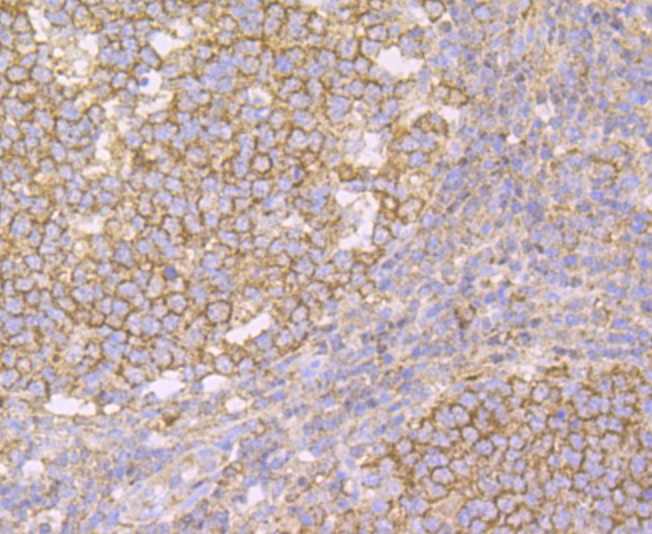 IMPDH2 Rabbit mAb