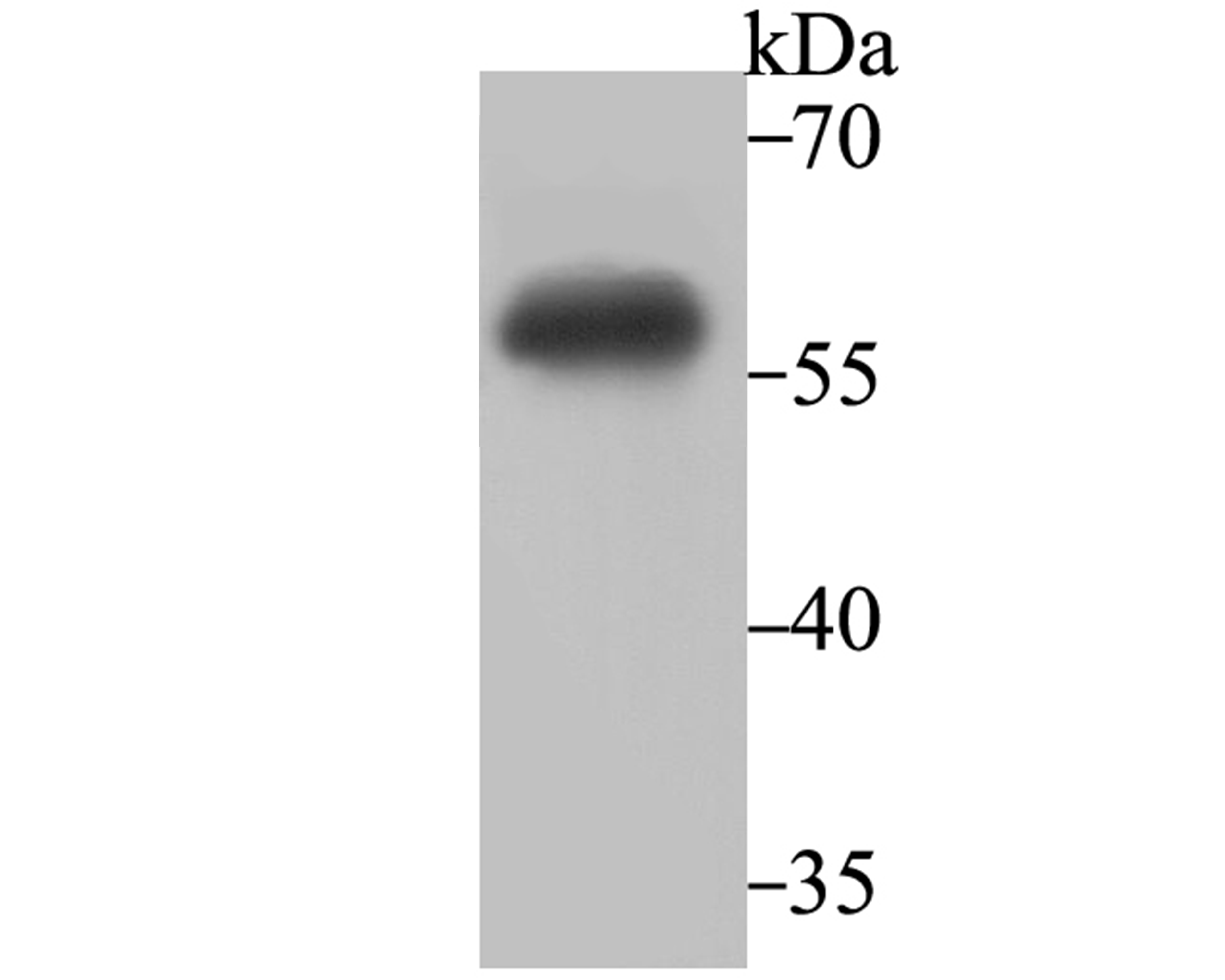 IMPDH2 Rabbit mAb