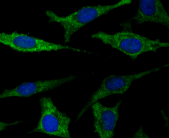 TTC11 Rabbit mAb