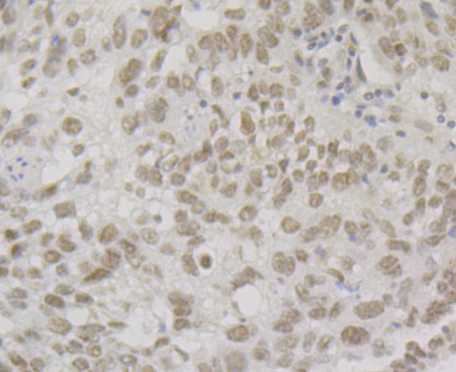 BAF57 Rabbit mAb