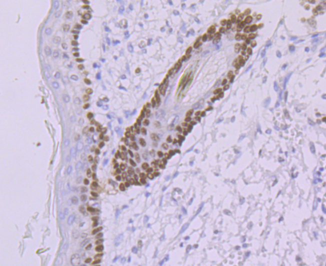 DDB2 Rabbit mAb