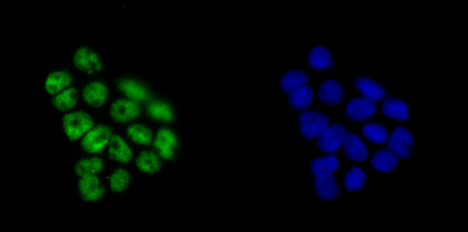 KHSRP Rabbit mAb