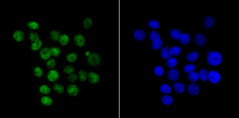 KHSRP Rabbit mAb