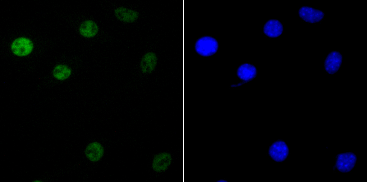 KHSRP Rabbit mAb