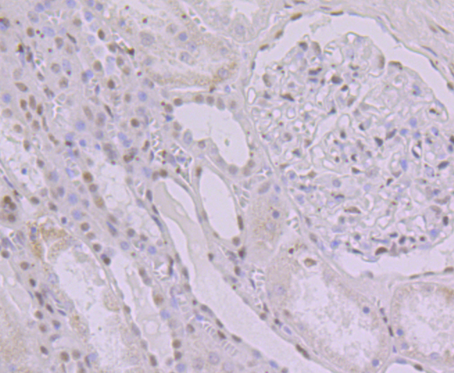 KHSRP Rabbit mAb