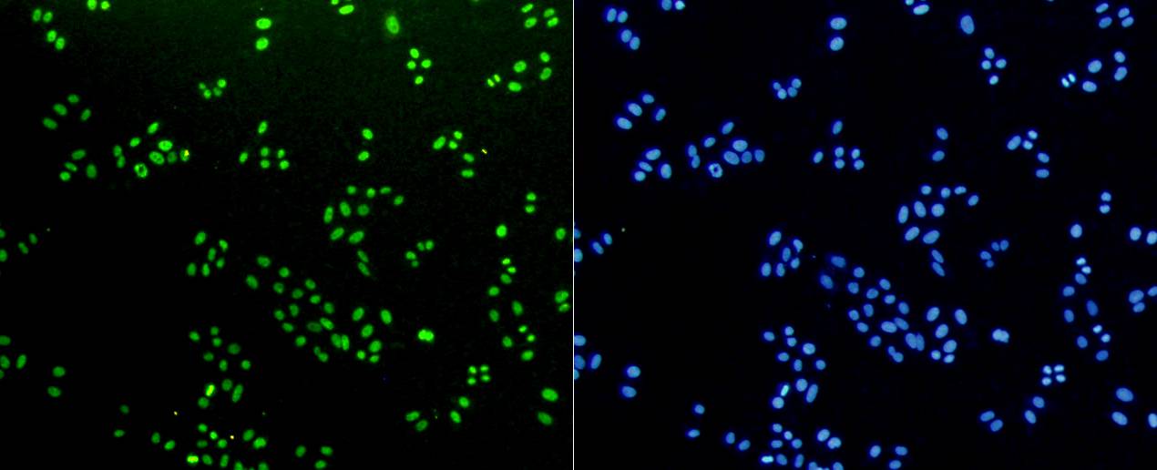 Histone H3(mono methyl K18) Rabbit mAb