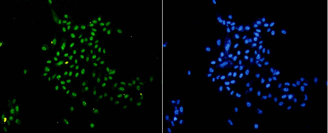 Histone H3(mono methyl K18) Rabbit mAb