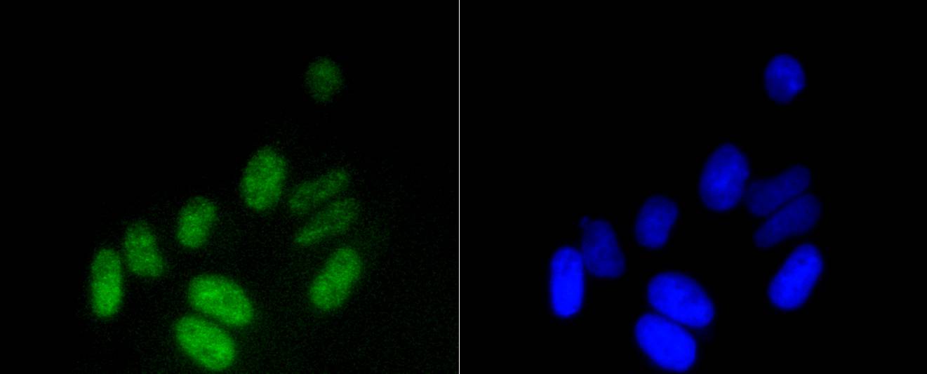 Histone H3(mono methyl K18) Rabbit mAb