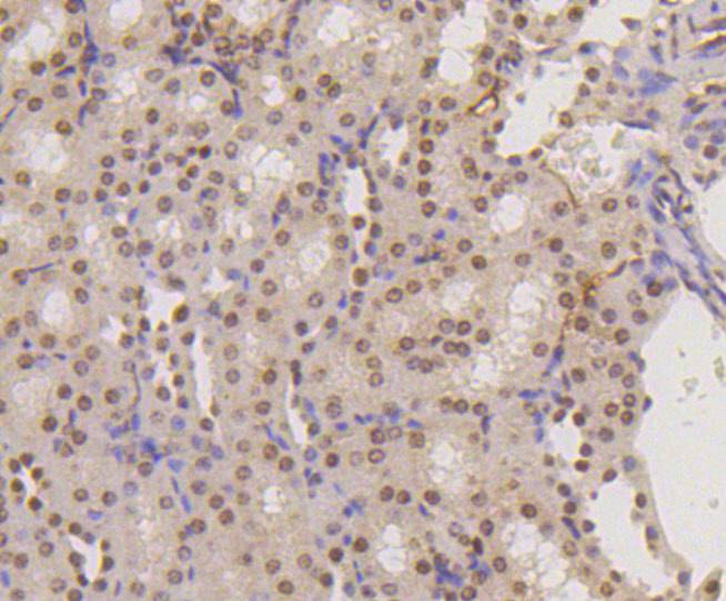 Histone H3(mono methyl K18) Rabbit mAb