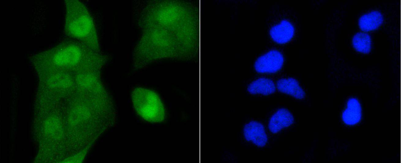 Histone H2A(acetyl K9) Rabbit mAb