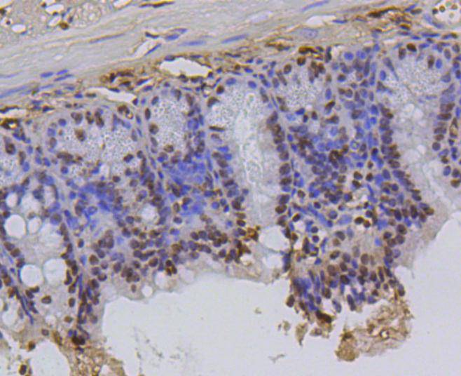 Histone H2A(hydroxyl Y39) Rabbit mAb