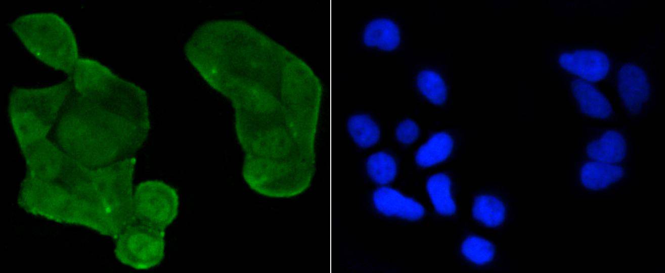 p53(acetyl K370) Rabbit mAb