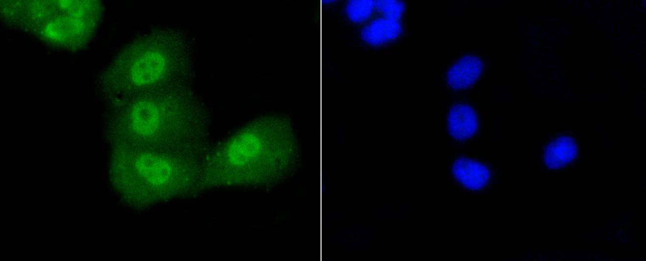 p53(acetyl K370) Rabbit mAb