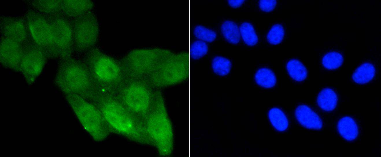 p53(acetyl K370) Rabbit mAb