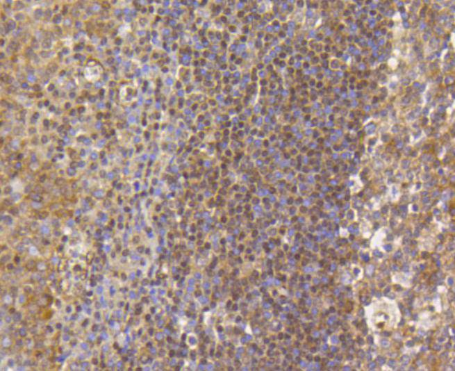 Histone H3(mono+di+methyl K79) Rabbit mAb