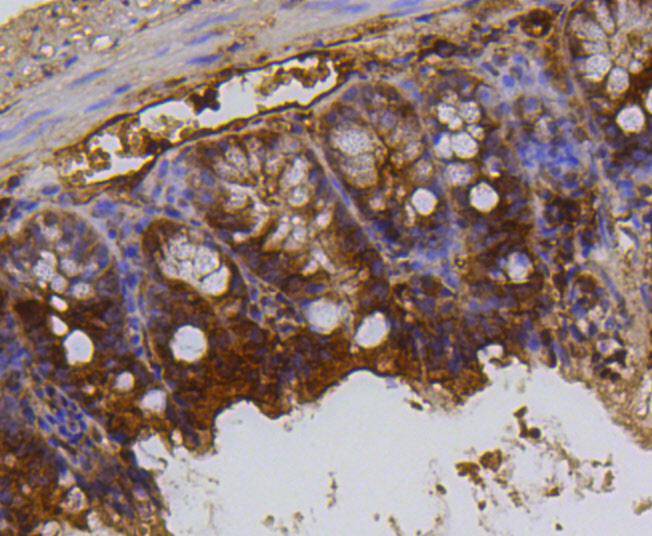 Histone H3(mono+di+methyl K79) Rabbit mAb