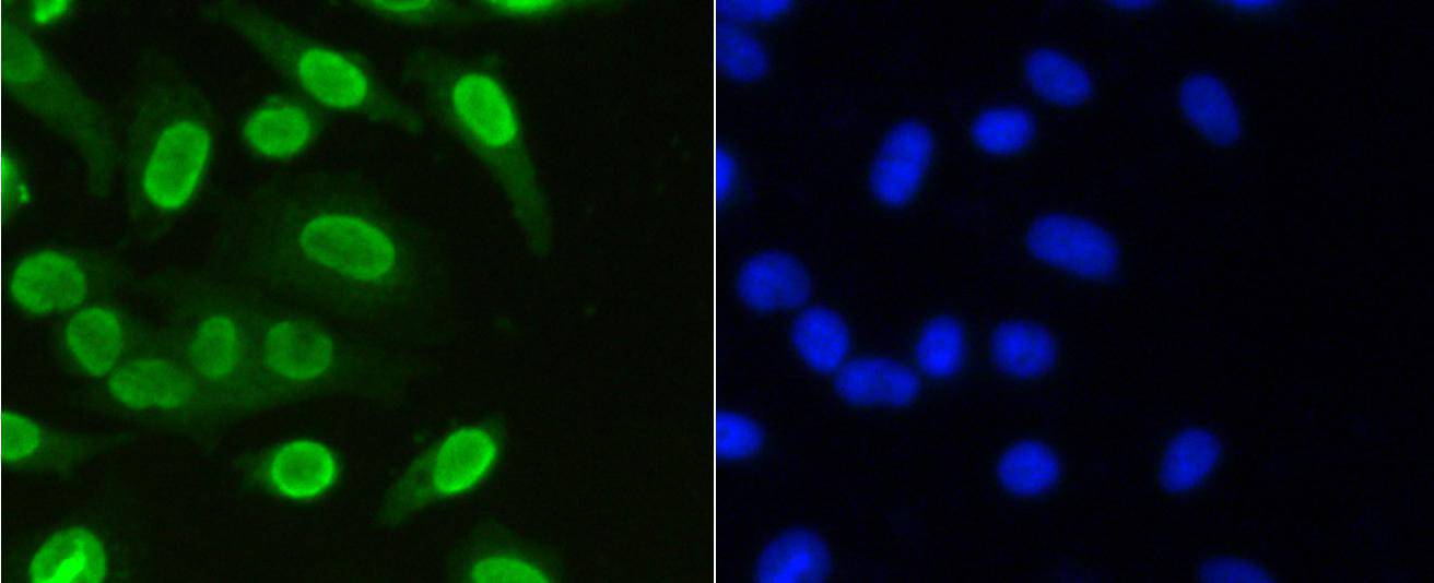 Histone H3(mono methyl K36) Rabbit mAb