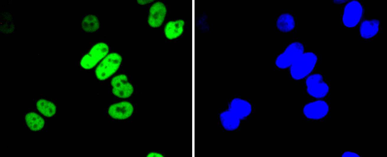 Histone H3(acetyl K56) Rabbit mAb