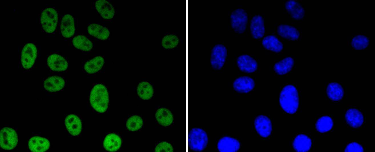 Histone H3(acetyl K56) Rabbit mAb