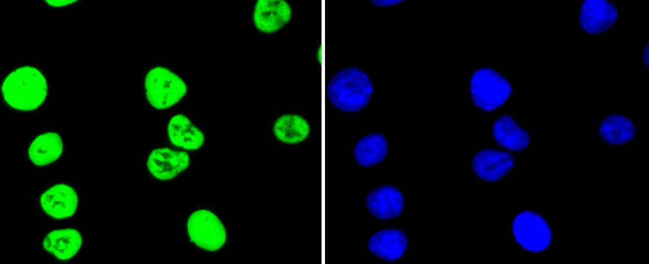 Histone H3(acetyl K56) Rabbit mAb