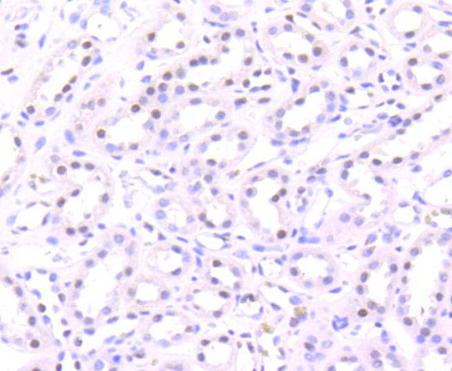 Histone H3(acetyl K56) Rabbit mAb