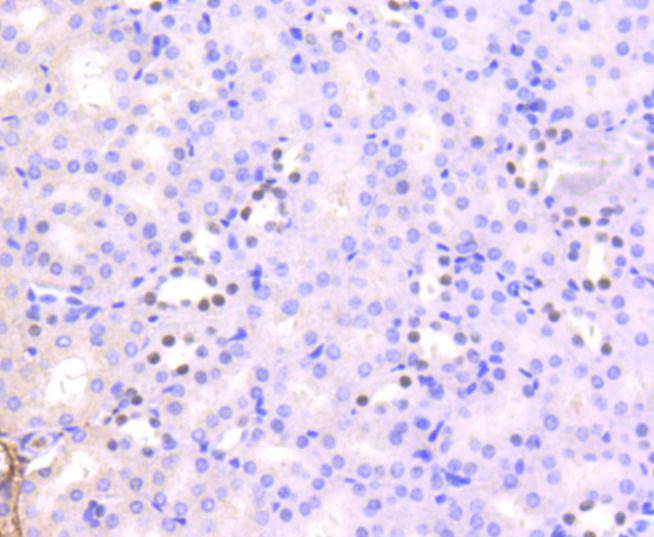 Histone H3(acetyl K56) Rabbit mAb