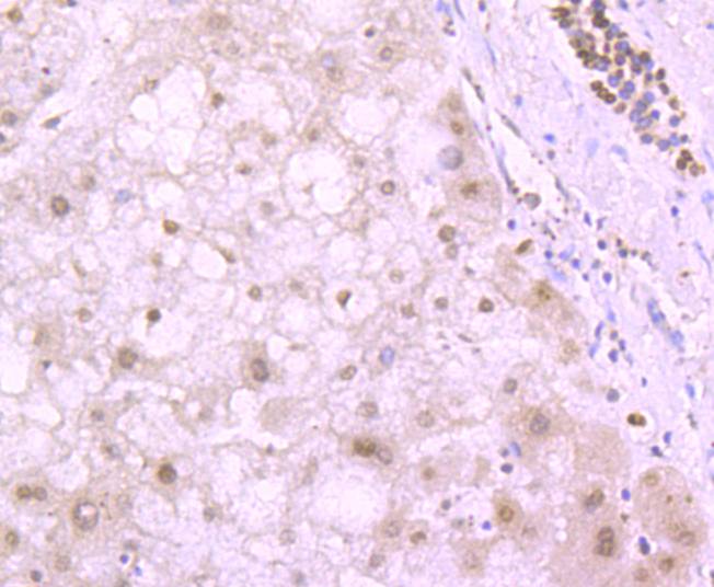 Histone H4 (tri methyl K20) Rabbit mAb