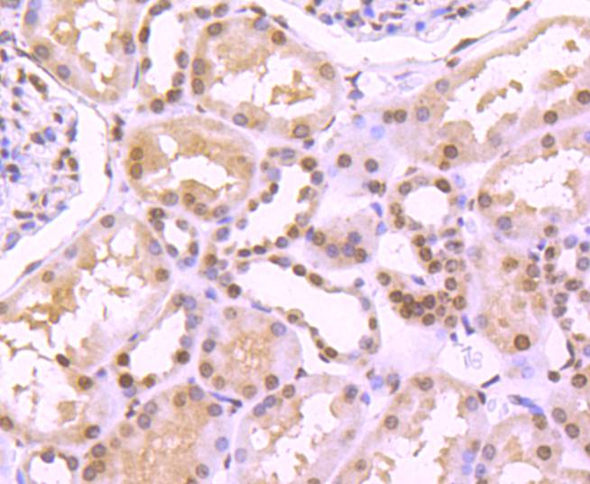 Histone H4 (tri methyl K20) Rabbit mAb