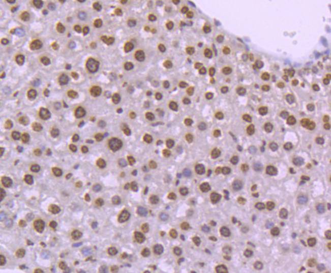 Histone H4 (tri methyl K20) Rabbit mAb