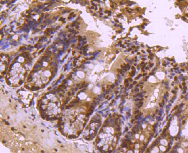 Histone H4 (tri methyl K20) Rabbit mAb