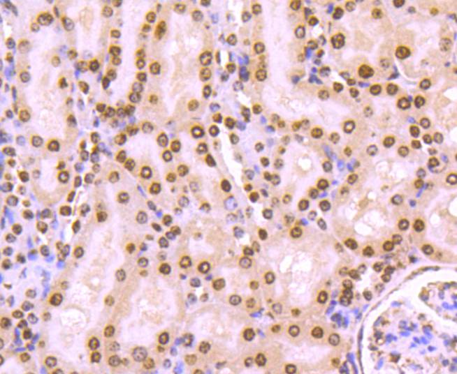 Histone H4 (tri methyl K20) Rabbit mAb