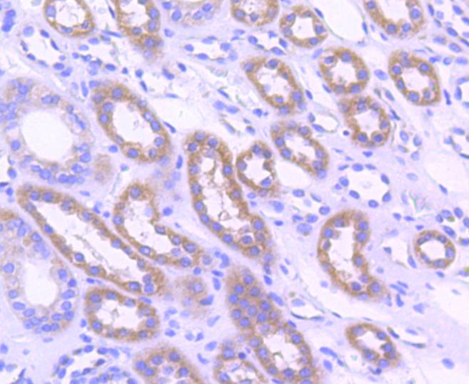 Acetyl CoA Carboxylase 1(ACC1) Rabbit mAb