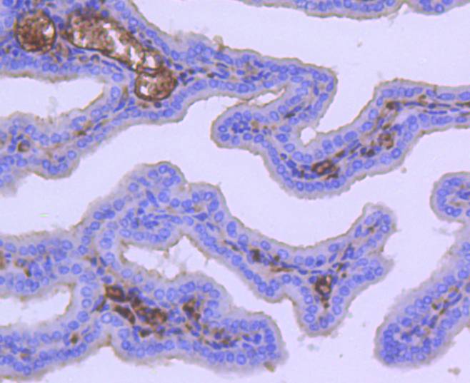 Acetyl CoA Carboxylase 1(ACC1) Rabbit mAb