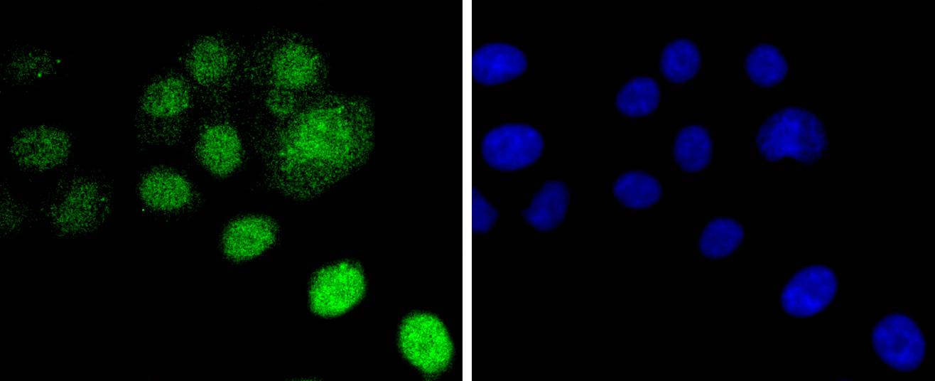 Histone H2B(mono methyl R79) Rabbit mAb