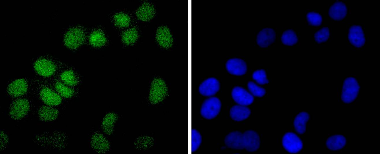 Histone H2B(mono methyl R79) Rabbit mAb