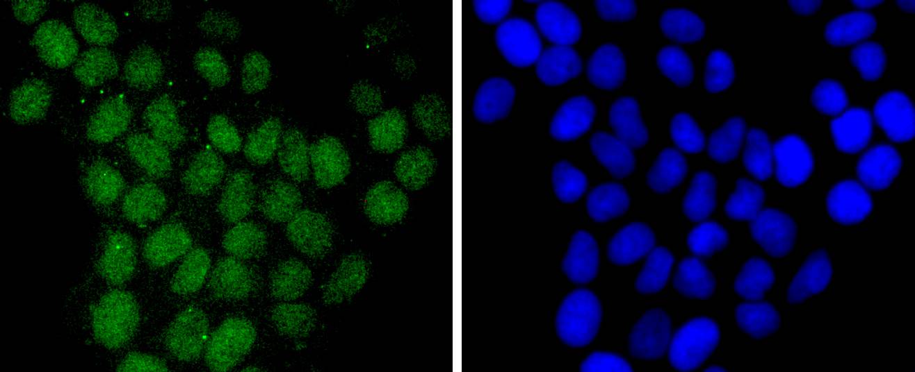 Histone H2B(mono methyl R79) Rabbit mAb