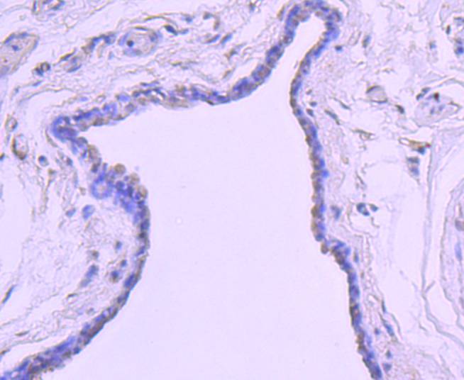 Histone H2B(mono methyl R79) Rabbit mAb