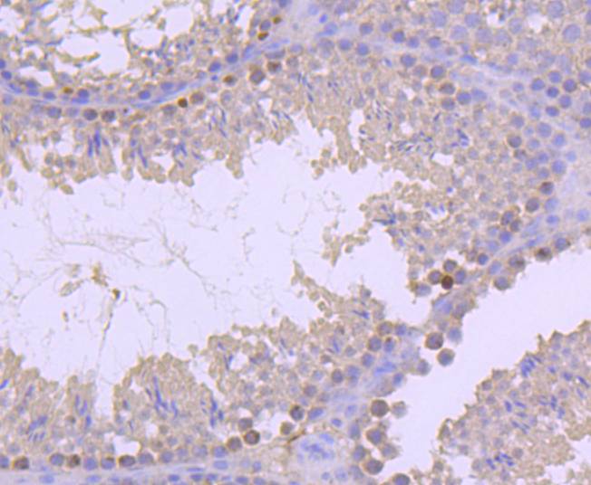 Histone H2B(mono methyl R79) Rabbit mAb