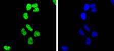 Histone H2B(acetyl K20) Rabbit mAb