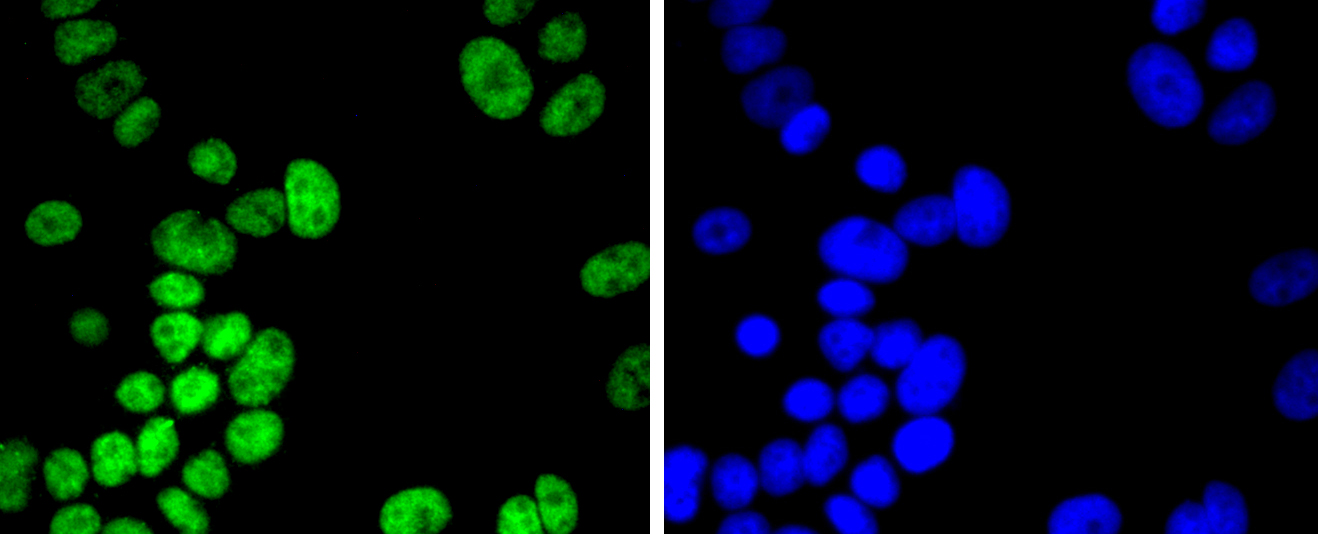 Histone H2B(acetyl K20) Rabbit mAb