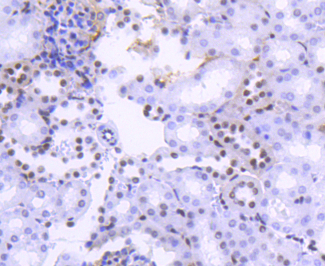 Histone H2B(acetyl K20) Rabbit mAb