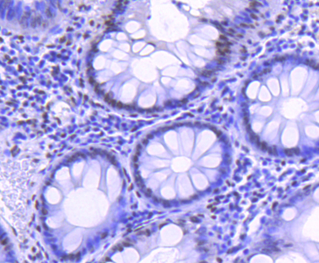 Histone H2B(acetyl K20) Rabbit mAb