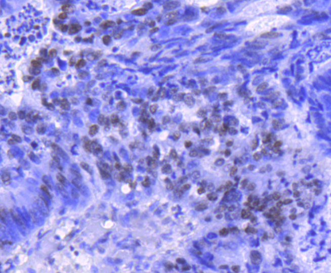 Histone H2B(acetyl K20) Rabbit mAb