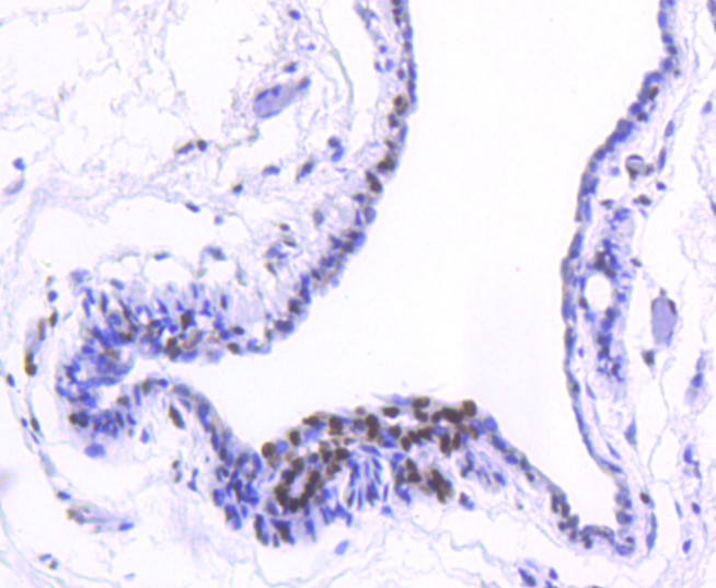 Histone H2B(acetyl K20) Rabbit mAb