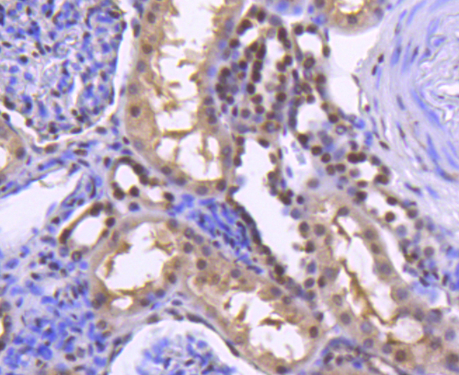 Histone H2B(acetyl K20) Rabbit mAb