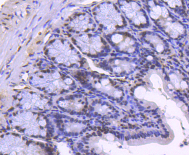 Histone H2B(acetyl K20) Rabbit mAb